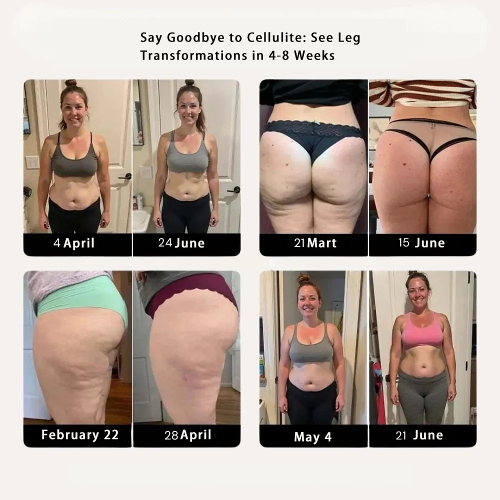 Women's Anti-Cellulite Massaging 3D Leggings